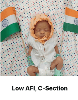 iMumz fertility success story 5